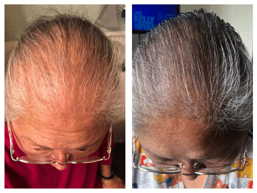 ScalpMed Review: Are these hair growth products effective?