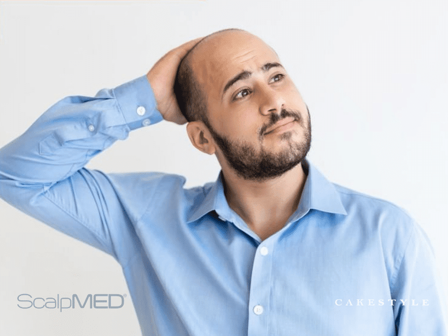 ScalpMED for Men: Which Products Should You Choose?